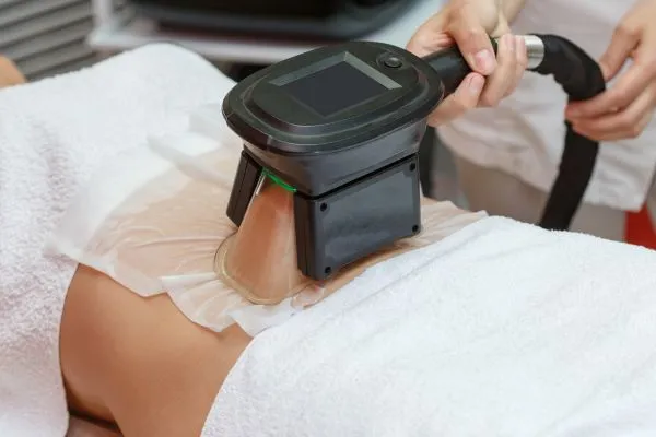 Image of person having fat freezing treatment to help weight gain Worksop