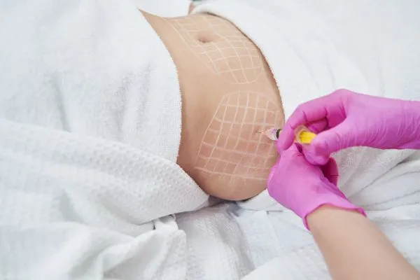 image of fat dissolving injections on love handles to help combat weight gain Worksop