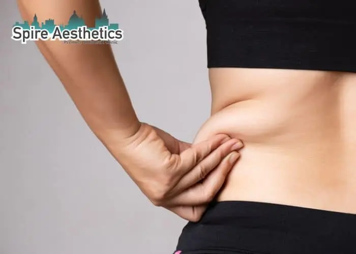 Image of woman pinching fat on their hips Worksop. Fat Freezing treatment