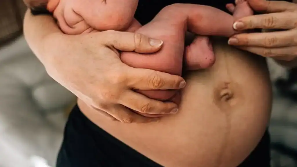 Why Is My Stomach Still Big After Pregnancy Worksop?