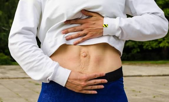When Could Diastasis Recti Be the Missing Piece of the Puzzle Worksop?